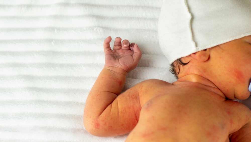 A new born baby lying on a bed representing the possibility birth injury lawsuits in Louisiana