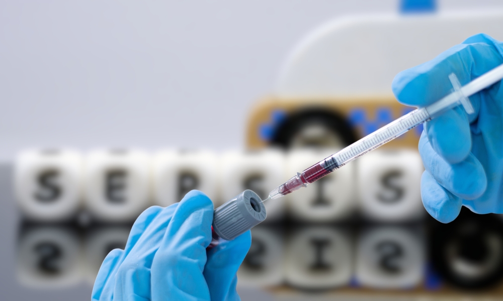 An image of a blood test post draw to test for sepsis malpractice